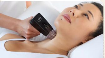 Clinician gliding an RF skin-tightening handpiece along a relaxed patient's jawline